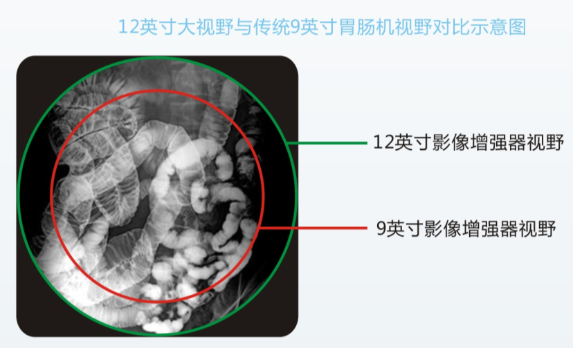 數(shù)字化平板胃腸機(jī)PLD8600B