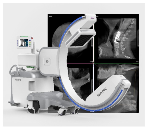 骨科C臂X光機
